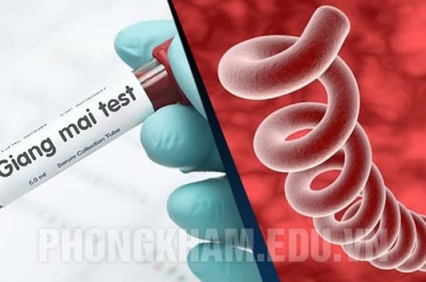 Bệnh giang mai là gì? Nguyên nhân, dấu hiệu, tác hại và cách chữa trị