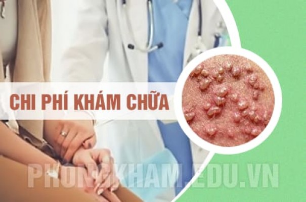 Chi phí khám chữa Mụn rộp sinh dục hết bao nhiêu tiền (Bảng giá 2025)