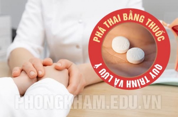 Phá thai bằng thuốc là gì? Quy trình và lưu ý khi sử dụng