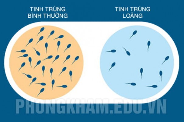 Tinh trùng loãng là như thế nào? Có sao không? Cách chữa trị