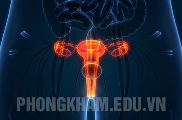 Bệnh viêm buồng trứng là gì? Nguyên nhân, triệu chứng và cách chữa trị