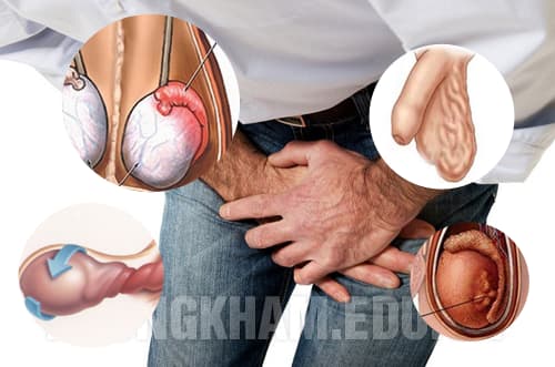 bệnh về tinh hoàn