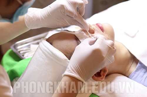 Cách chữa trị mụn trứng cá