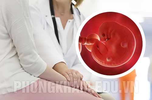 Bác sĩ sản phụ khao tư vấn các cách phá thai an toàn hiện nay