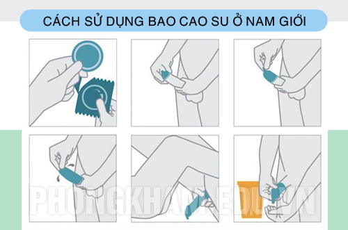 cách sử dụng bao cao su ở nam giới