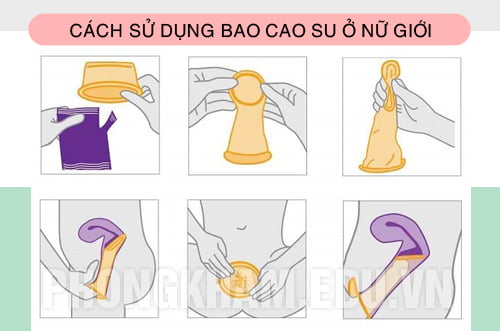 cách sử dụng bao cao su ở nữ giới