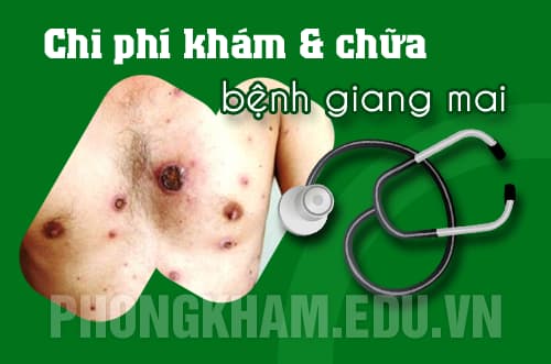 chi phí khám chữa bệnh sùi mào gà