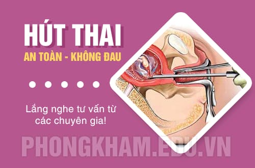 phương pháp hút thai an toàn không là gì