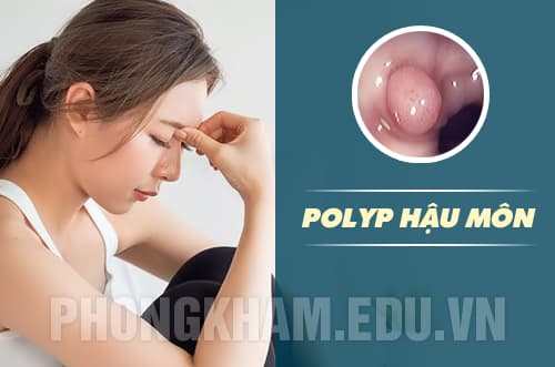polyp hậu môn