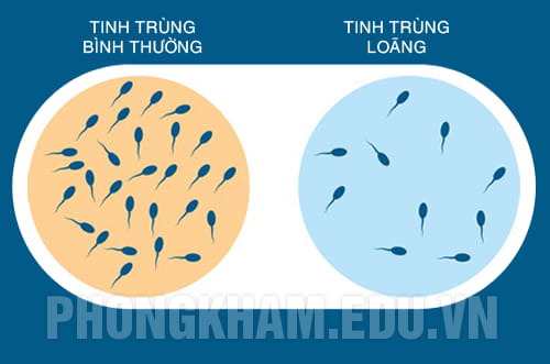 tinh trùng loãng