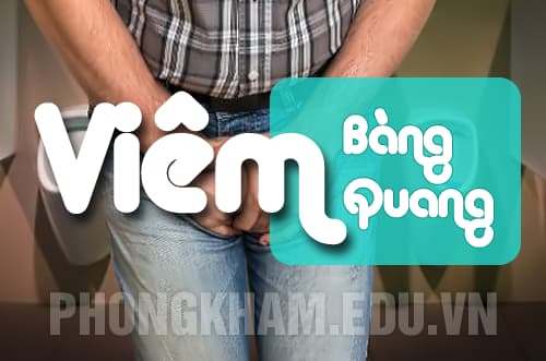Viêm bàng quang ở nam