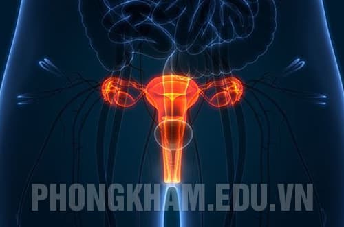 Bệnh viêm buồng trứng