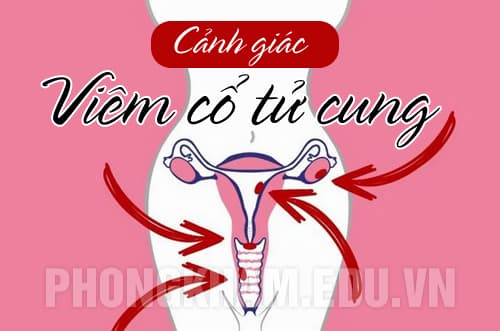 Bệnh viêm cổ tử cung